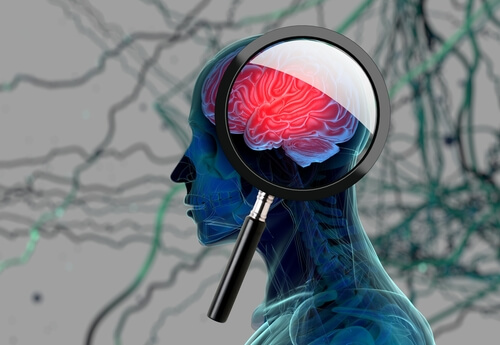 Cerebro con infección