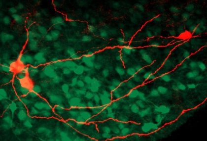 La corteza insular y su relación con los acontecimientos dolorosos