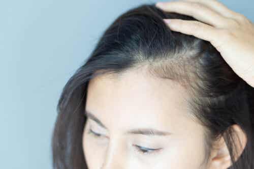 Implicaciones psicológicas de la alopecia en mujeres