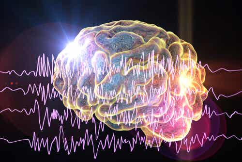 Cerebro con crisis epilépticas