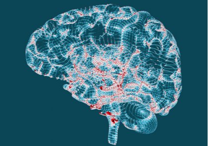 Enfermedad de Huntington