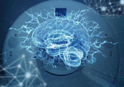 Imagenología cerebral, la mejor manera de ver tu cerebro