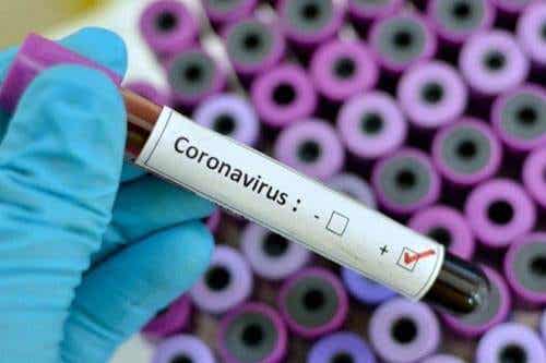 Muestra de Coronavirus o neumonía de Wuhan