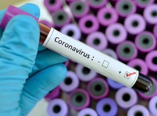 muestras de sangre representando los consejos psicológicos ante el coronavirus