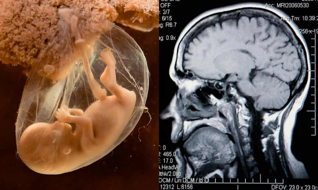 Kind en brein