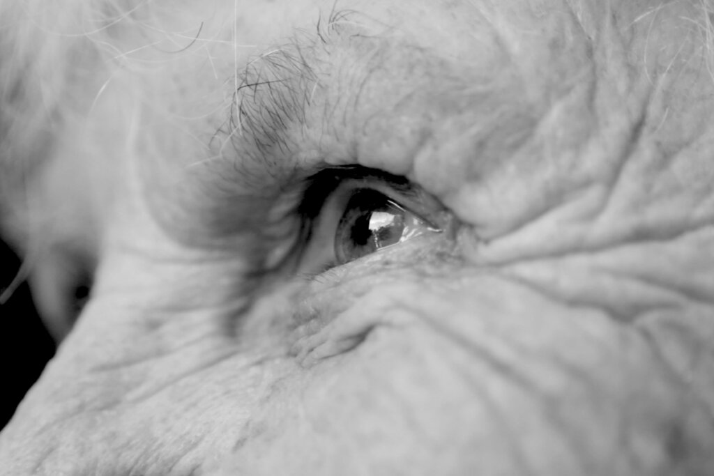 Síndrome de Anton: el ciego que dice ver