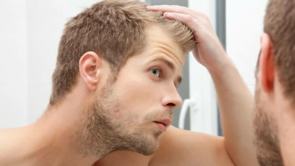 Chico rubio que sufre perdida de cabello por ansiedad