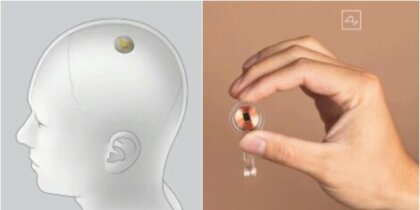 Neuralink: el chip que conectará el cerebro a un ordenador