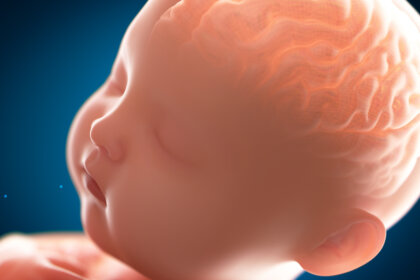 Paquigiria: el cerebro "liso"