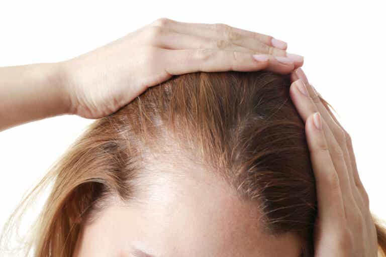 Alopecia nerviosa: síntomas, causas y tratamientos