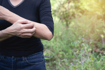 ¿Qué es el síndrome de Ekbom?