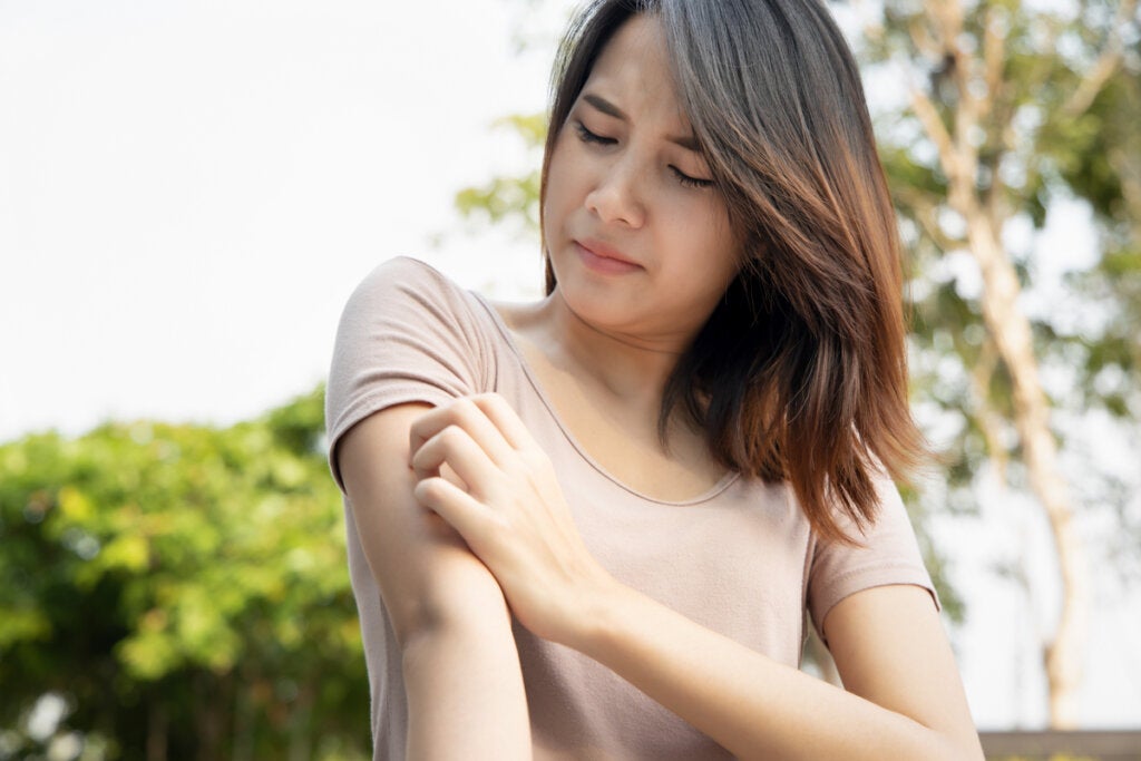 Mujer con picores en el brazo por el síndrome de Ekbom