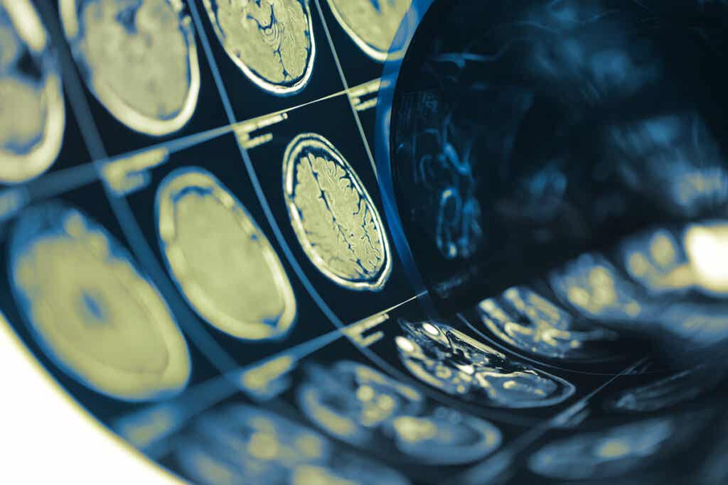 Pruebas de un cerebro para ver relación de la Neurocriminología