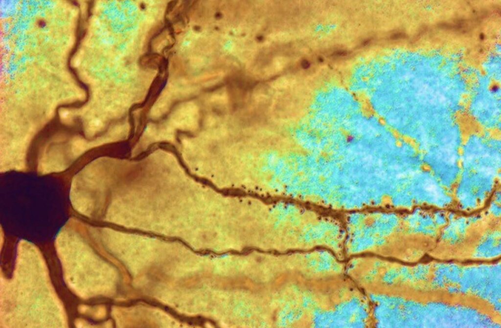 células representando las neuronas de las personas inteligentes son más grandes