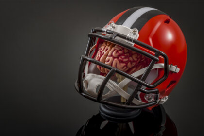 Encefalopatía traumática crónica y su relación con la NFL