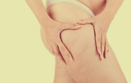 Lipedema, más allá de la obesidad: síntomas y tratamiento