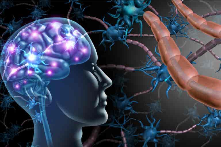 Diferencias entre esclerosis múltiple y ELA