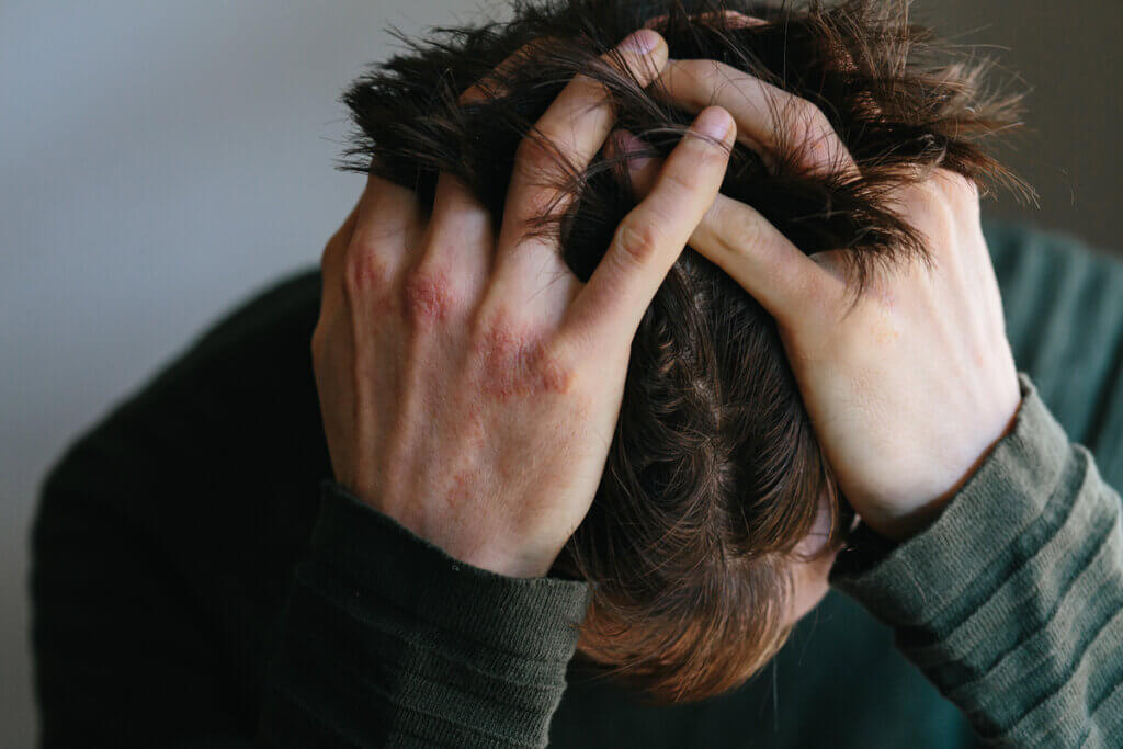 fatigue d'anxiété extrême