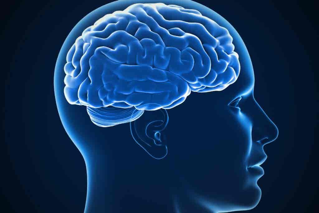 Cerebro que evidencia síndrome de dehiscencia