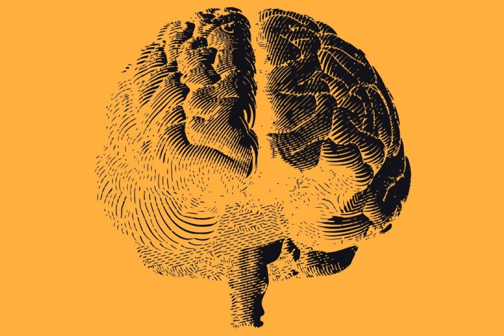 Stampa dell'emisfero cerebrale raffigurante il legame tra dopamina e schizofrenia