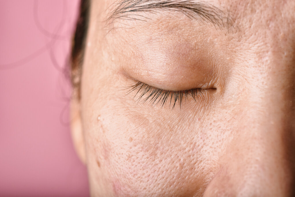 Woman with spots on her face