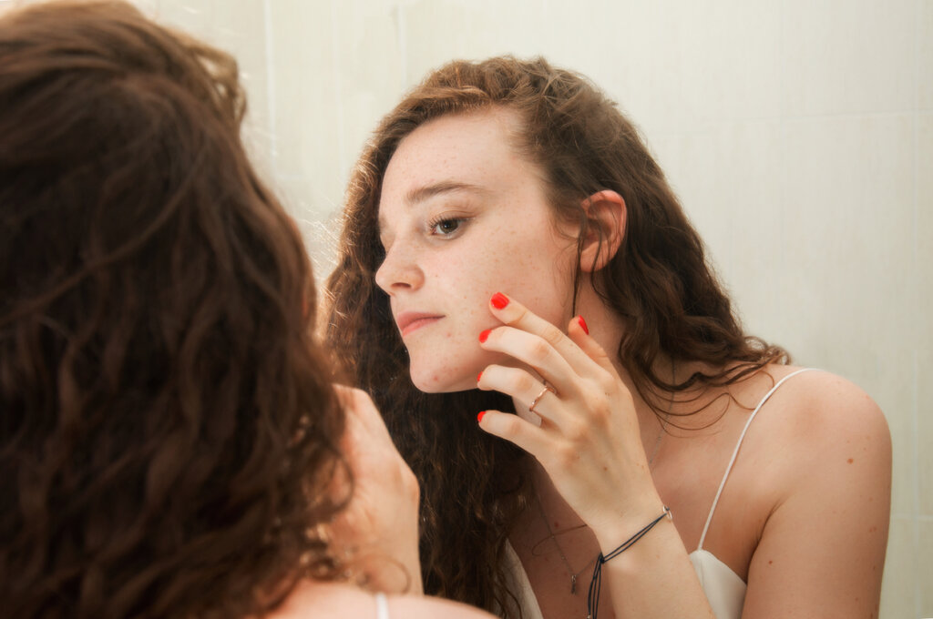 Adolescente mirándose el rostro con acné en el espejo.