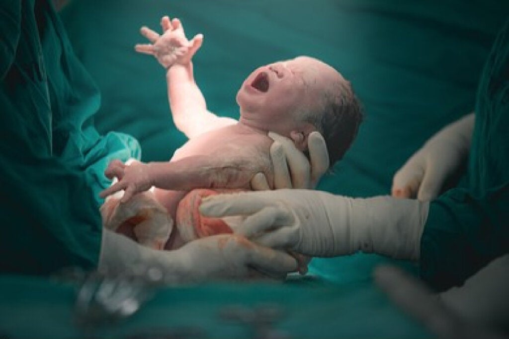 출산에 관한 신생아의 뇌