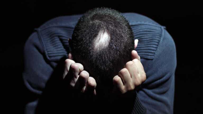Alopecia areata y estrés: cómo se relacionan
